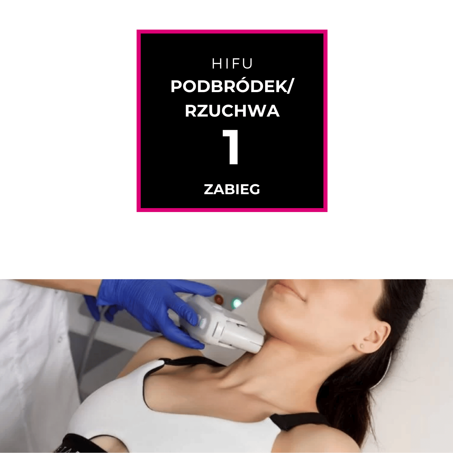 HIFU Podbródek / Żuchwa