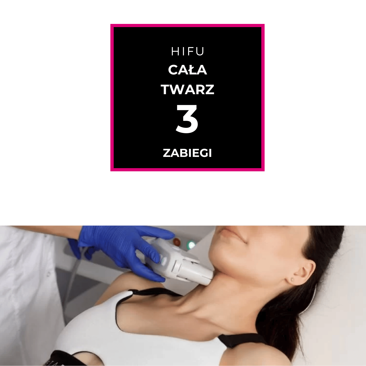 HIFU Cała twarz - obrazek 2