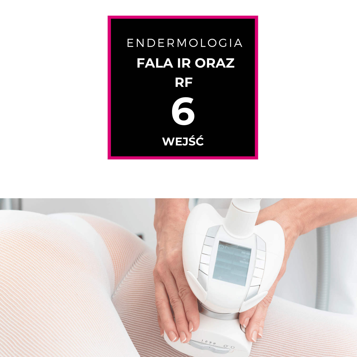 Endermologia + Fala IR oraz RF