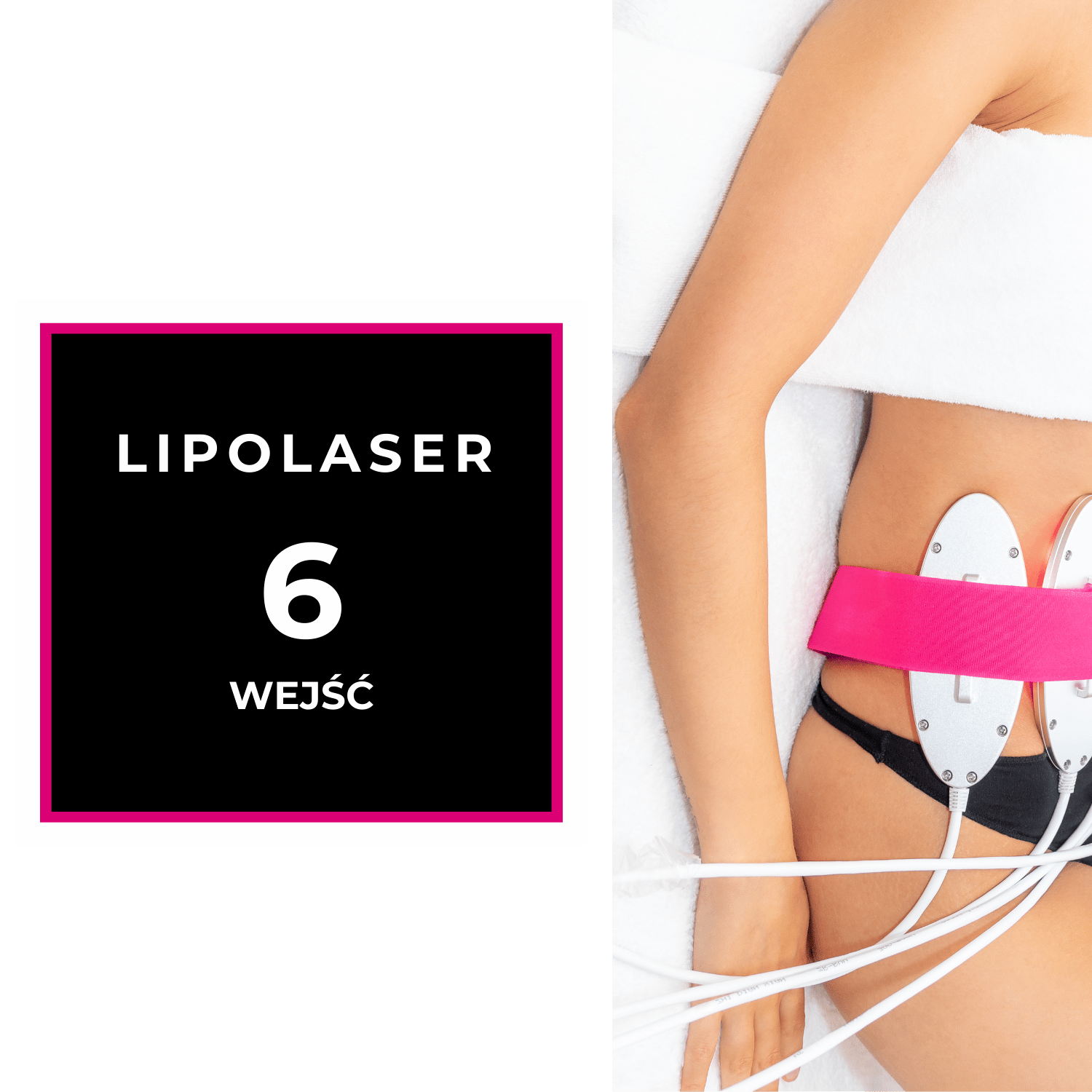 Lipolaser
